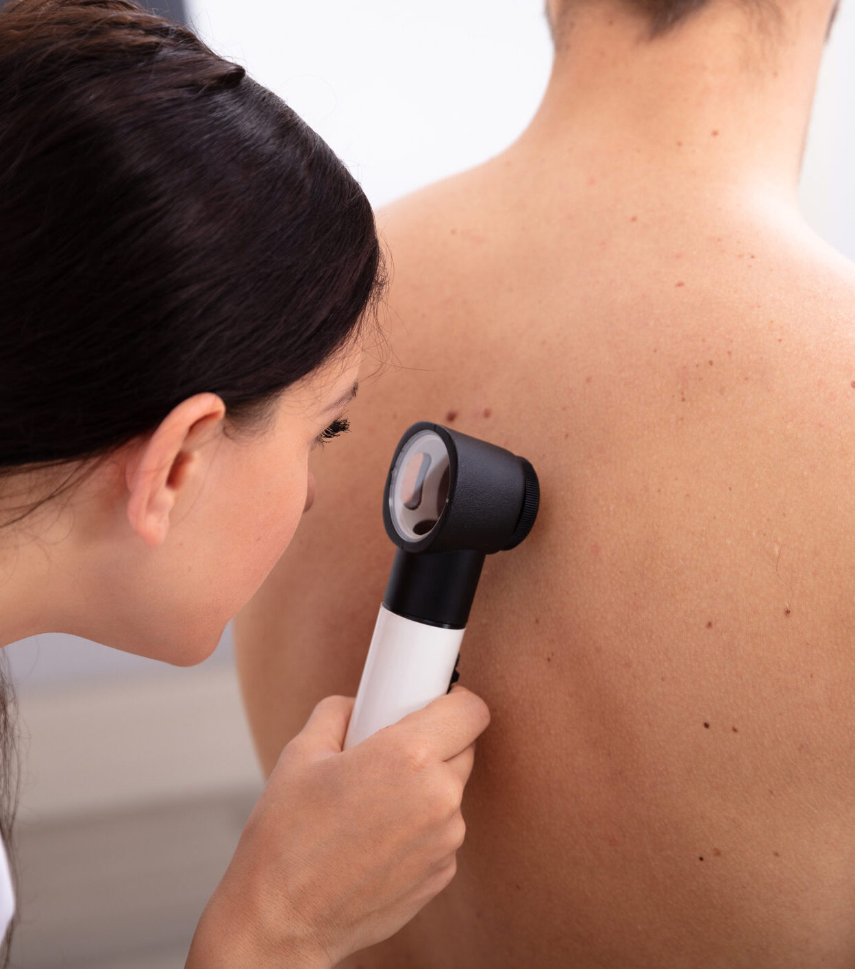 Female Doctor Examining Pigmented Skin On Man's Back With Dermatoscope